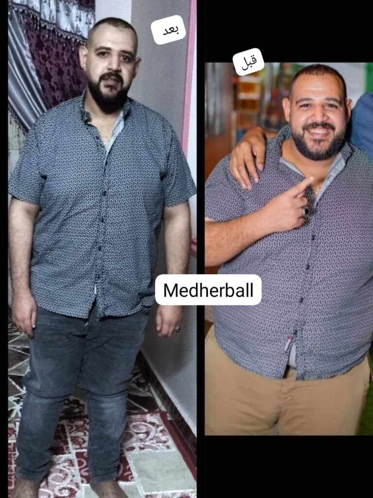 تخسيس قبل وبعد
