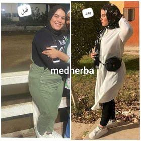 تخسيس قبل وبعد2