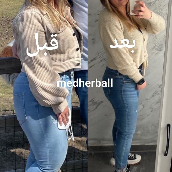 تخسيس قبل وبعد